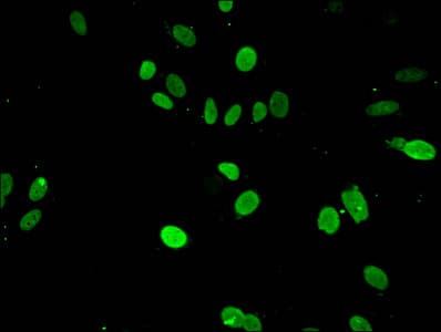 Polyclonal Rabbit anti-Human HIST1H3A Antibody (IHC, IF, WB)