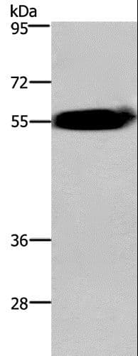 ACVR2 / ACVR2A Antibody