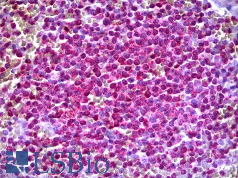 IHC-plus™ ARHGEF11 Antibody (clone 2H7)