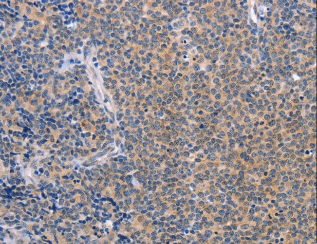 CCL16 / LEC Antibody