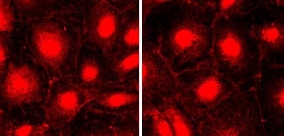 NPHS1 / Nephrin Antibody (aa1243-1256)