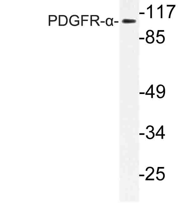 PDGFRA / PDGFR Alpha Antibody (Ile843)