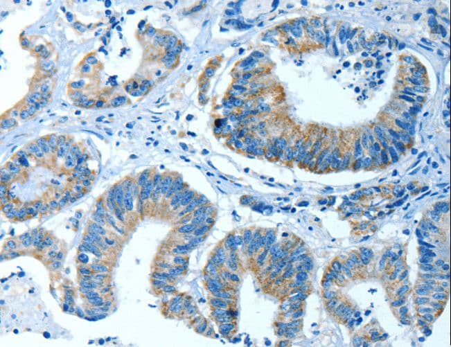 P5CDH / ALDH4A1 Antibody
