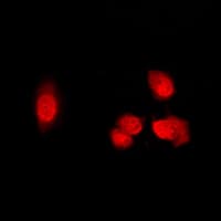 HDAC5 Antibody (phospho-Ser498)