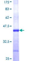 Human PGGT1B Protein (Recombinant GST, N-terminus)