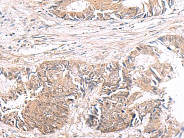 HMGCLL1 Antibody