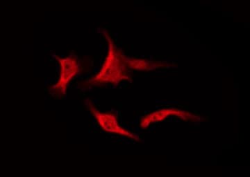 PRKCZ / PKC-Zeta Antibody (phospho-Thr410)