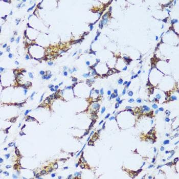 Polyclonal Rabbit anti-Human C1QG / Complement C1QC Antibody (IHC)