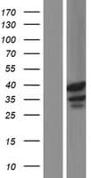 TSPY1 / TSPY Protein (Over-Expression Lysate Myc-DDK (Flag))