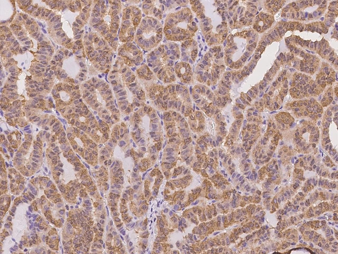 APRT Antibody (Preservative Free)