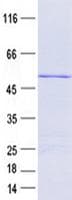 Human TRIM17 / RNF16 Protein (Recombinant His, N-Terminal)