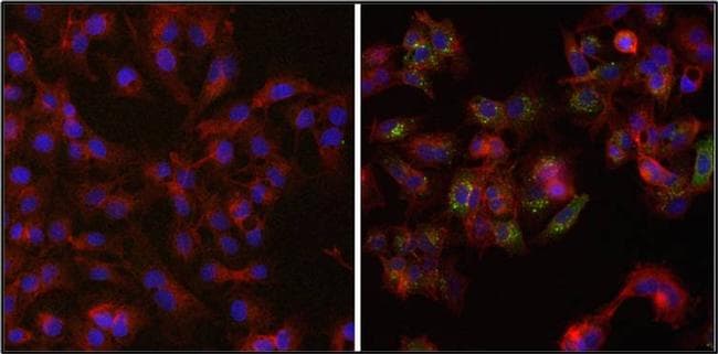 Ferritin Antibody (clone 521)