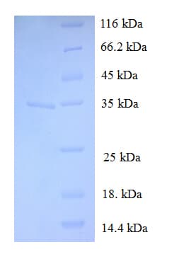 Human C19orf33 / IMUP Protein (Recombinant GST)