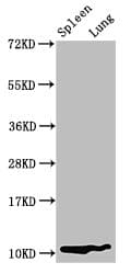 S100A8 / MRP8 Antibody (aa2-89)