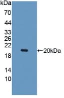 IL10RB Antibody (aa87-243)
