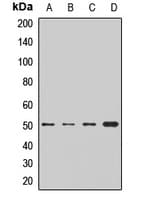 BCKDHA / BCKDE1A Antibody