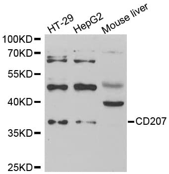 IHC-plus™ CD207 / Langerin Antibody