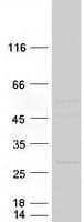 Human Klra1 / Ly49 Protein (Recombinant Myc-DDK (Flag))