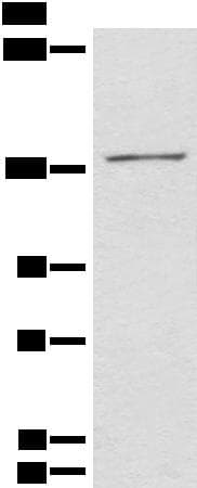 Polyclonal Rabbit anti-Human HIPK2 Antibody (IHC, WB)