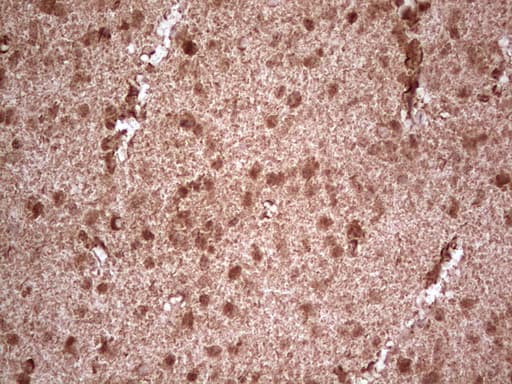 NEFM / NF-M Antibody (aa413-773, clone OTI5B7, Carrier-free)