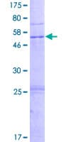 Human PRSS33 Protein (Recombinant GST)