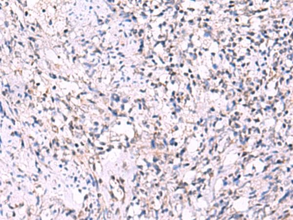 Polyclonal Rabbit anti-Human ECSIT Antibody (IHC, WB)