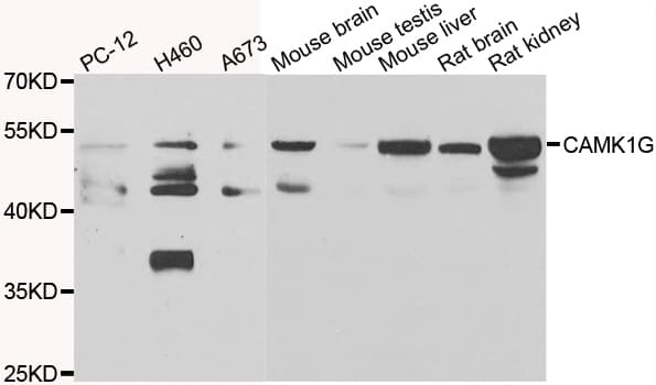 Polyclonal Rabbit anti-Human CAMK1G / CaMKI gamma Antibody (IHC, WB)