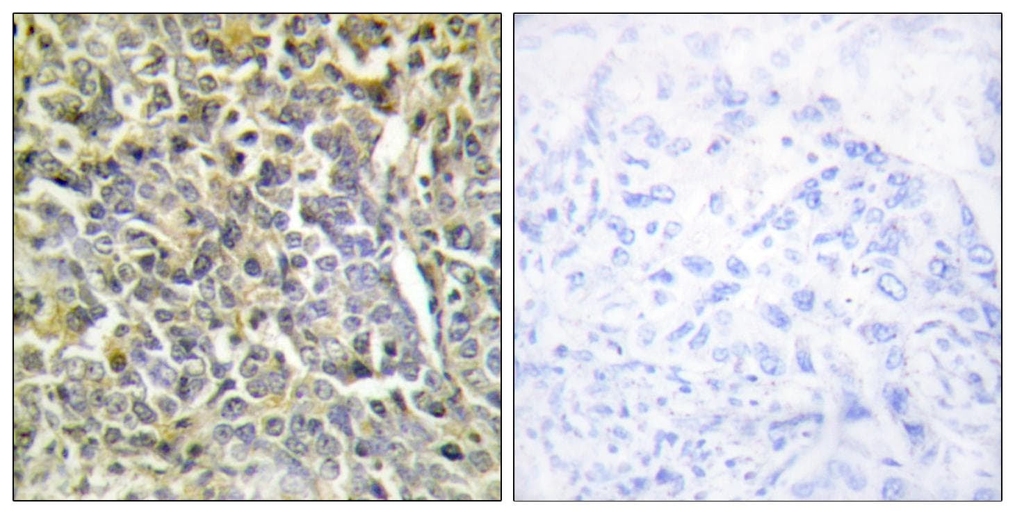 COL6A2 / Collagen VI Alpha 2 Antibody