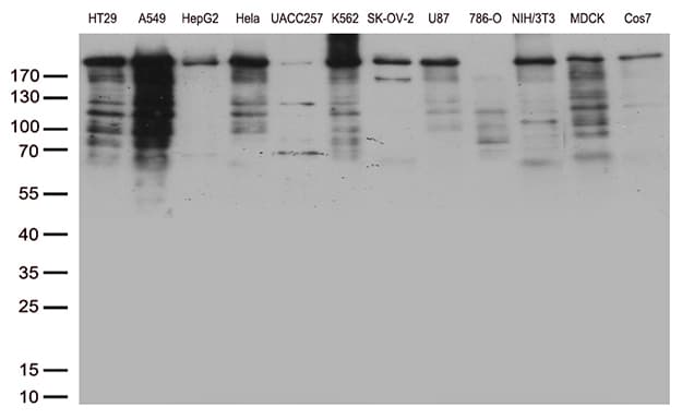 POLR2A / RNA polymerase II Antibody (aa1351-1614, clone OTI2B7)