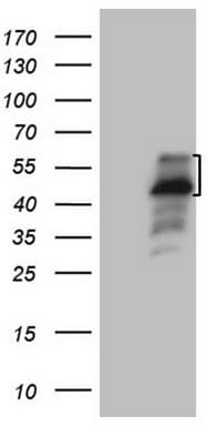 DJ858B16.2 / PISD Antibody (aa80-340, clone OTI2C1, Carrier-free)