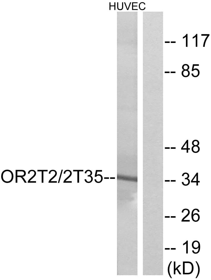 OR2T2 + OR2T35 Antibody (Internal)