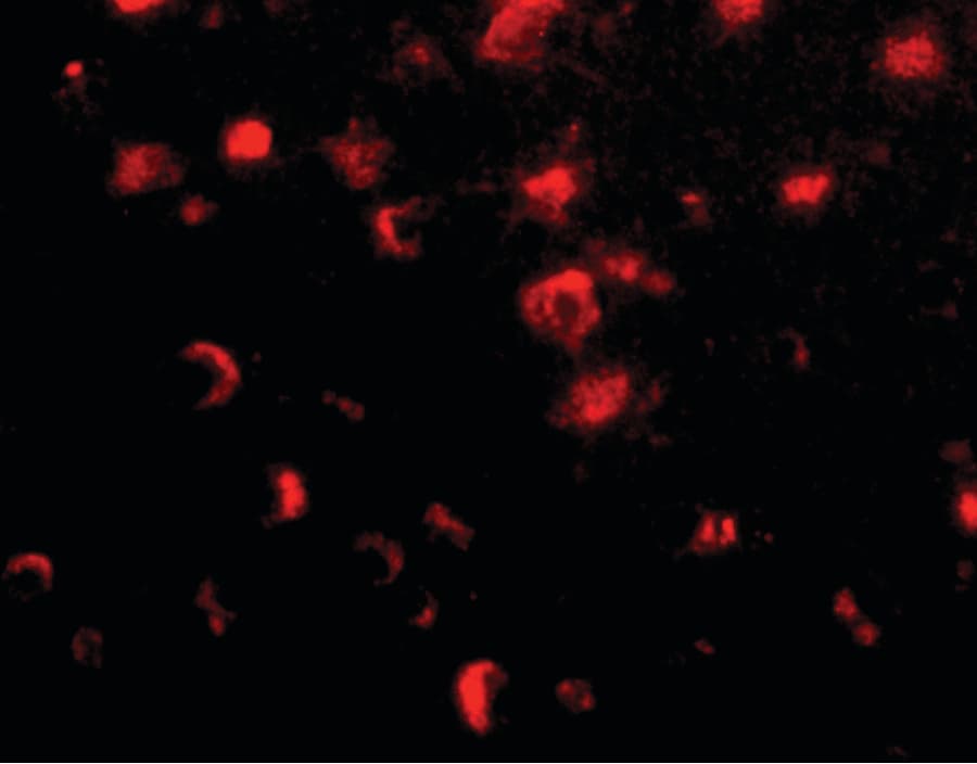 SLITRK1 Antibody