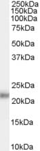 Polyclonal Goat anti-Human KLK2 / Kallikrein 2 Antibody (aa107-120, IHC, WB)
