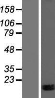 C21orf34 Protein (Over-Expression Lysate Myc-DDK (Flag))