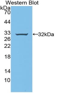 RNF112 / ZNF179 Antibody (aa256-504)