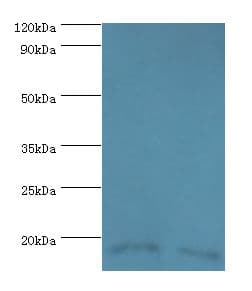 FKBP2 Antibody (aa22-142)