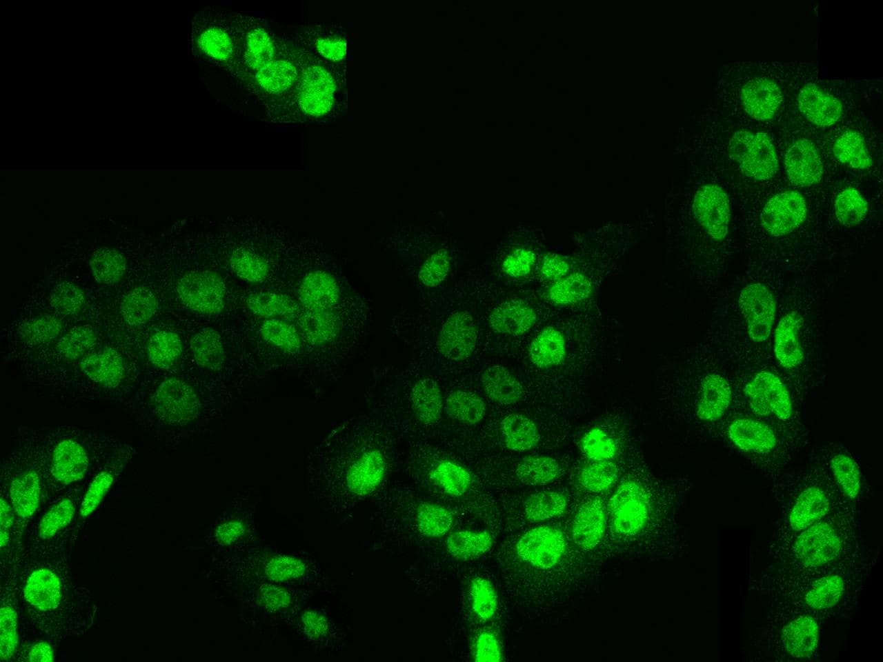 KLF17 Antibody (Preservative Free)