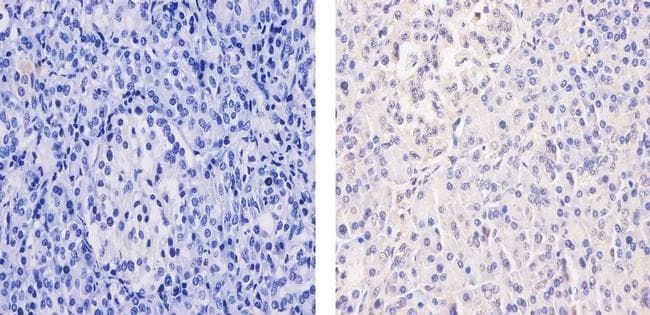 Monoclonal Mouse anti-Human NR3C1/Glucocorticoid Receptor Antibody (clone 6000000, IHC, IF, WB)