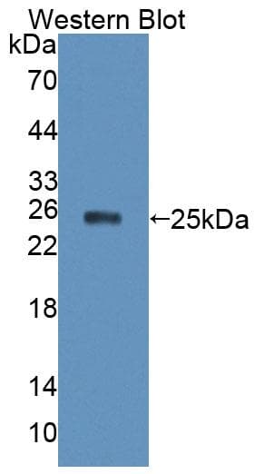 XPO5 / Exportin 5 Antibody (PE)