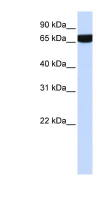 Polyclonal Rabbit anti-Human HS2ST1 Antibody (aa252-301, IHC, WB)