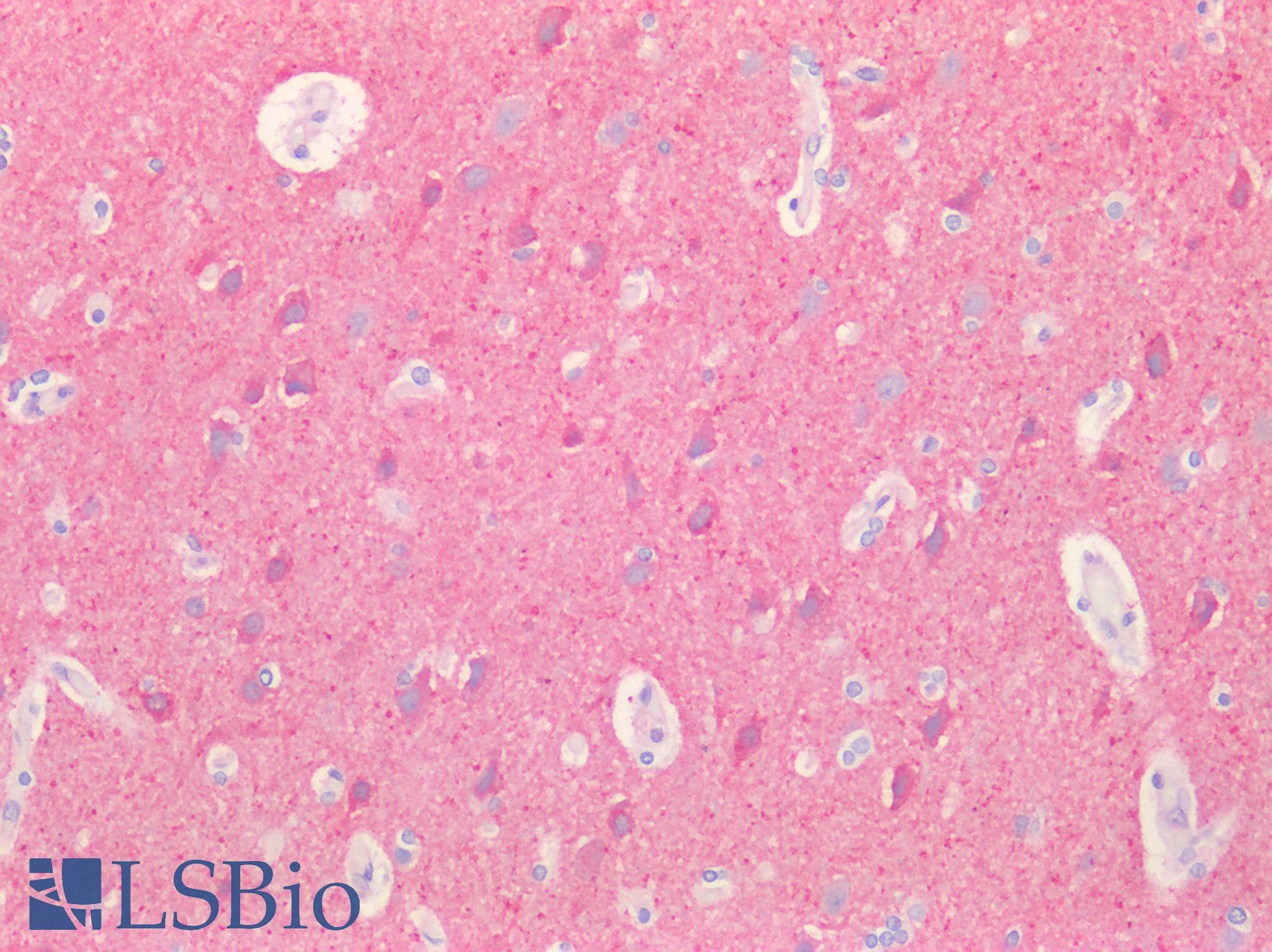 IHC-plus™ NCALD / Neurocalcin Delta Antibody