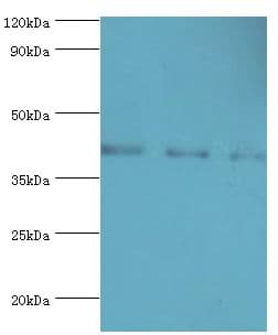 Polyclonal Rabbit anti-Human RRM2B / P53R2 Antibody (aa1-351, IHC, WB)