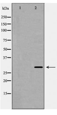 Polyclonal Rabbit anti-Human KCNIP3 / Dream / Calsenilin Antibody (IHC, IF, WB)