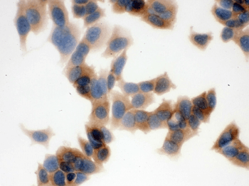FASN / Fatty Acid Synthase Antibody