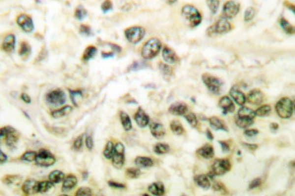 Polyclonal Rabbit anti-Human HDAC3 Antibody (Tyr414, IHC, IF, WB)