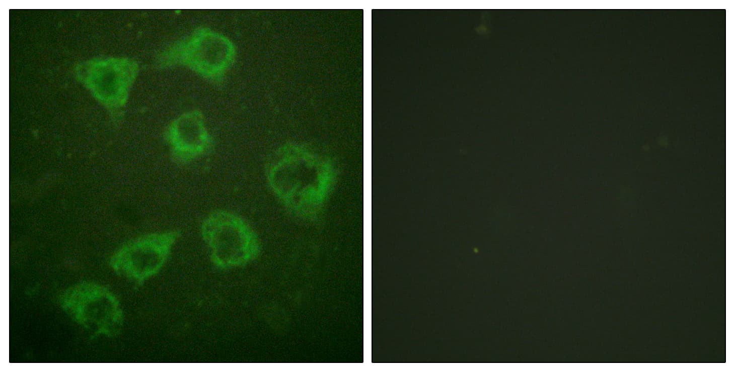 KSR1 Antibody (aa358-407)