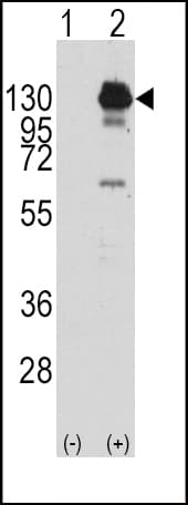 IHC-plus™ PDGFRA / PDGFR Alpha Antibody (Tyr762)
