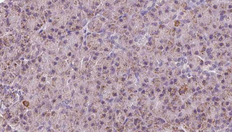 Polyclonal Rabbit anti-Human CTNNA3 / Alpha-3 Catenin Antibody (IHC, WB)