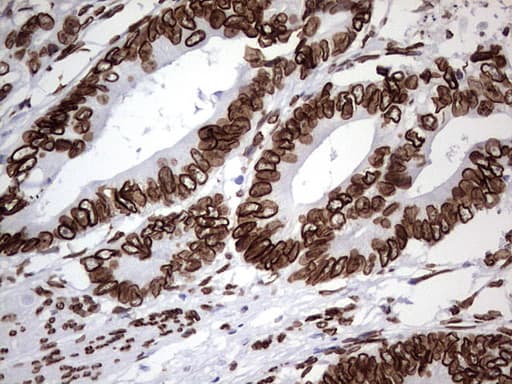 BCL6 Antibody (aa1-300, clone OTI1C3, Carrier-free)