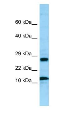 Polyclonal Rabbit anti-Human RPL21 / Ribosomal Protein L21 Antibody (aa79-128, WB)